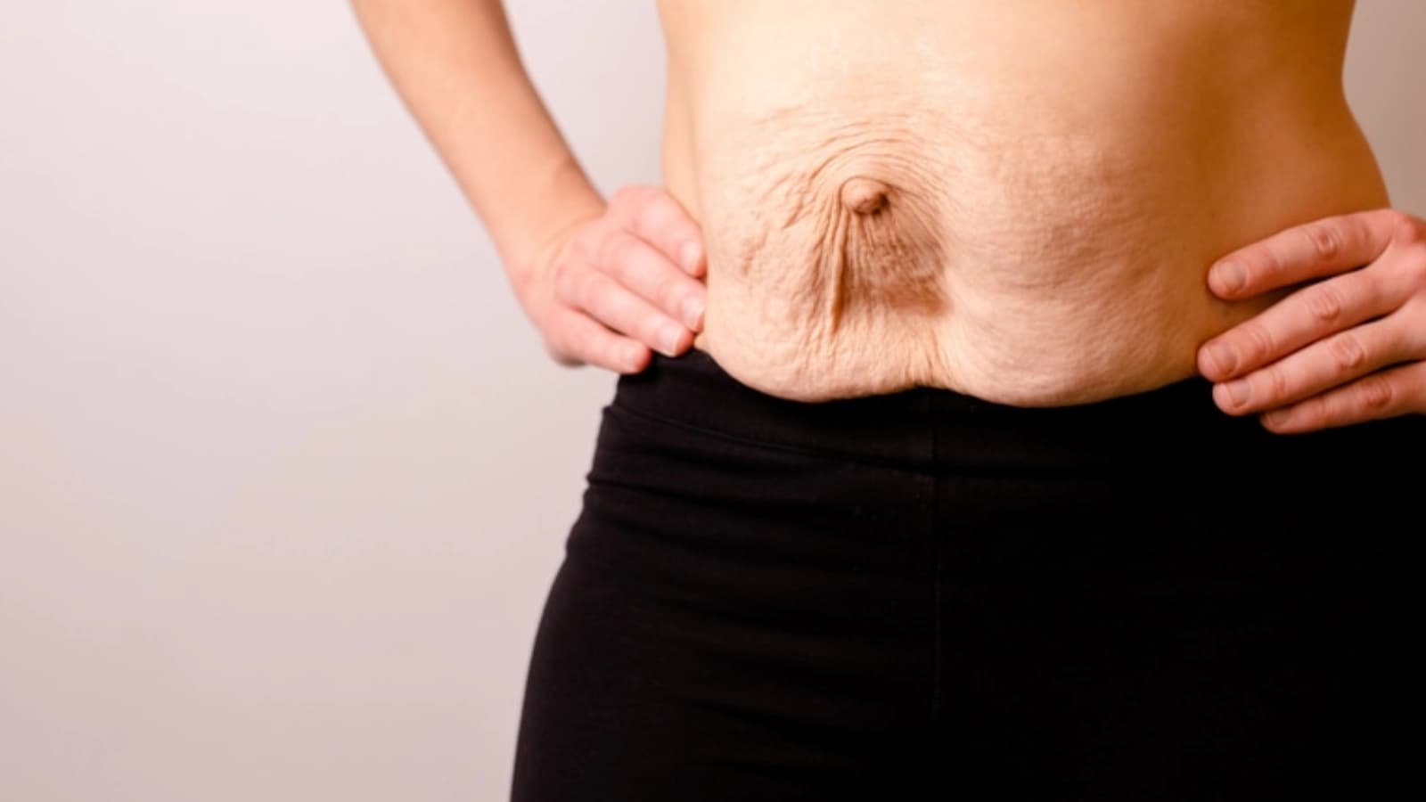 Diástase dos Retos Abdominais